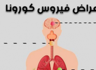 انفوغراف: ما هي عوارض فيروس كورونا !